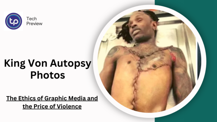 King Von Autopsy Photos